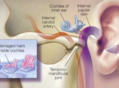 tinnitus